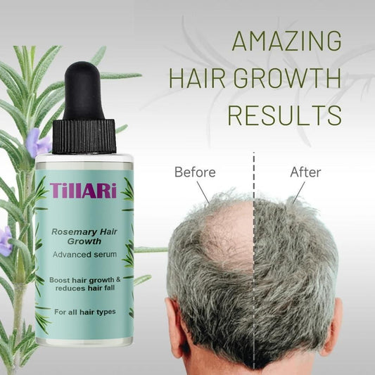Rosemary Hair Growth Serum (Pack of 2)