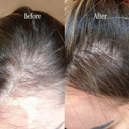 Rosemary Mint Scalp & Hair Strengthening Oil